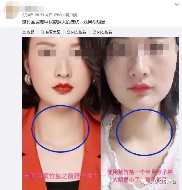 产品宣传问题引人关注，揭底四级代理的“禅吻”是何来历？